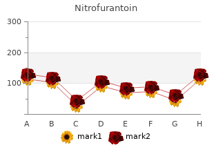 order nitrofurantoin pills in toronto