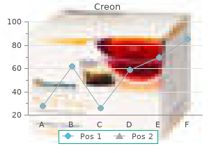 generic 150mg creon mastercard