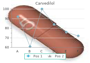 buy carvedilol without prescription