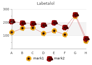 buy cheap labetalol 100mg on line