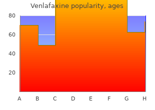 order 37.5 mg venlafaxine free shipping