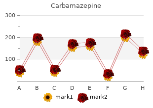 order carbamazepine mastercard