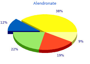 buy generic alendronate 35 mg on-line