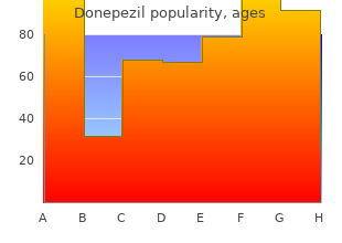 buy donepezil on line amex